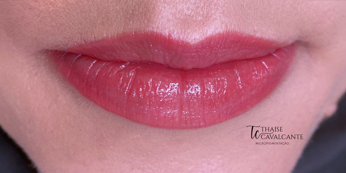 Suavizze Lips — Resultado natural