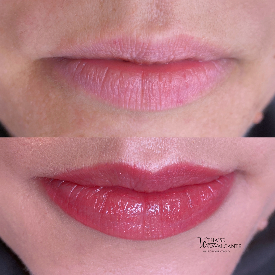 Resultado Suavizze Lips